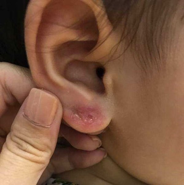 Cách đeo bông tai không bị đau 